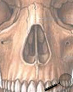 Le septum nasal est la cloison médiane séparant les cavités nasales 